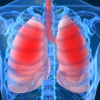 Nuovo trattamento per enfisema polmonare