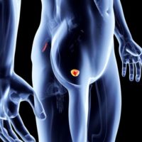Tumore della prostata: tra le possibili cause l’infiammazione cronica