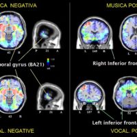 Il cervello riconosce il linguaggio delle emozioni nella musica