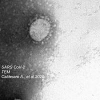 Il primo caso di isolamento da lattante del coronavirus SARS-CoV-2 all’Università di Parma