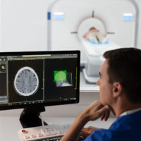 Philips Incisive CT diventa ancora più intelligente con il debutto di Precise Suite abilitato per AI