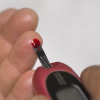 Perdita di peso record grazie al nuovo farmaco anti-diabete: avviata al Policlinico di Bari la sperimentazione