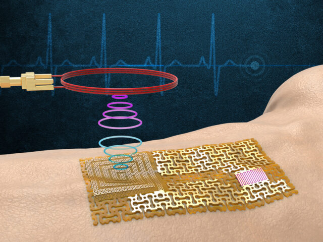 Dai riceratori del  MIT una “pelle” elettronica wireless senza chip