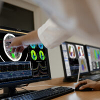 Philips presenta nuove soluzioni informatiche con intelligenza artificiale per aumentare l’affidabilità diagnostica