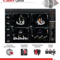 Pie Medical Imaging annuncia Caas Qardia 2.0