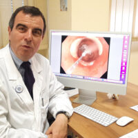 Gemelli: effettuata una crioablazione endoscopica per ‘cancellare’ le lesioni precancerose dell’esofago