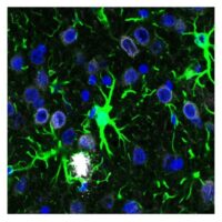 Alzheimer: alterazioni molecolari negli astrociti condizionano il cervello