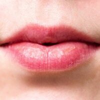 Labbra irritate e prurito: le cause più comuni