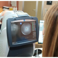 Introdotto in Casa Sollievo un nuovo macchinario per la diagnosi e la cura delle patologie oculari