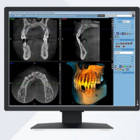 EIZO presenta il nuovo monitor medicale MX217