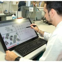 Al Reparto di Ematologia di Casa Sollievo della Sofferenza un potente microscopio per le diagnosi oncoematologiche di precisione