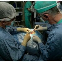 Eseguito un complesso intervento di rimodulazione di chirurgia implantologica endococleare a Casa Sollievo