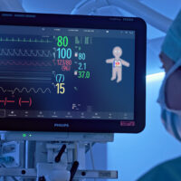 Philips lancia la nuova soluzione di monitoraggio Visual Patient Avatar
