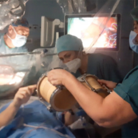 Cremona: il paziente suona le percussioni durante l’intervento