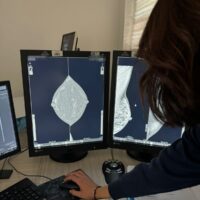 Ospedale Di Venere: arriva la mammografia con metodica CEM