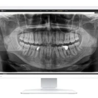 Da EIZO il nuovo monitor diagnostico per il settore dentale RadiForce MX243W-DT