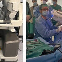 Eseguito a Tor Vergata un autotrapianto di rene con tecnica completamente robotica
