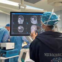 Policlinico di Bari: due nuovi neuronavigatori per la neurochirurgia